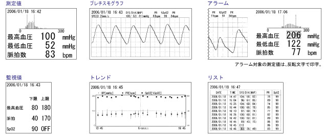 生物識(shí)別信息監(jiān)視器TM  -  2571 / TM  -  2572（重要盒）打印打印示例圖像